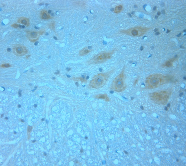 Synaptotagmin 1 Antibody in Immunohistochemistry (Paraffin) (IHC (P))