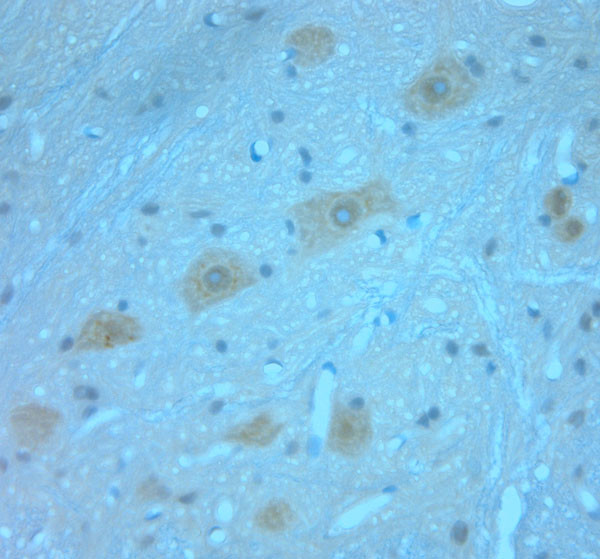 Synaptotagmin 1 Antibody in Immunohistochemistry (Paraffin) (IHC (P))