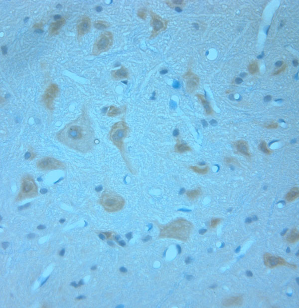 Synaptotagmin 1 Antibody in Immunohistochemistry (Paraffin) (IHC (P))