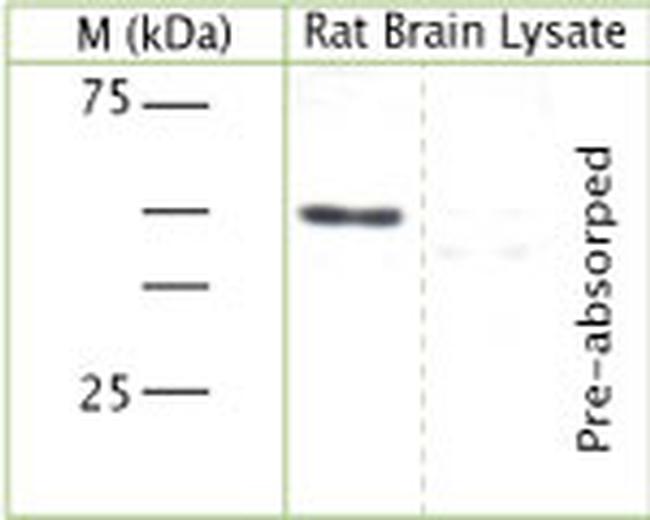 Synaptotagmin 1 Antibody in Western Blot (WB)