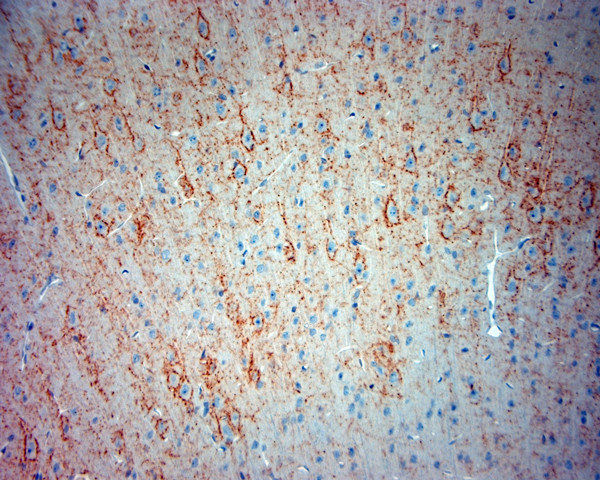 Synaptotagmin 2 Antibody in Immunohistochemistry (Paraffin) (IHC (P))