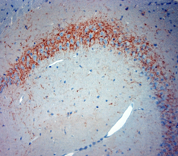 Synaptotagmin 2 Antibody in Immunohistochemistry (Paraffin) (IHC (P))