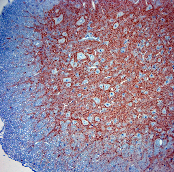 Synaptotagmin 2 Antibody in Immunohistochemistry (Paraffin) (IHC (P))