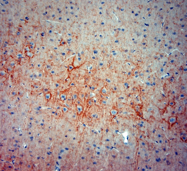 Synaptotagmin 2 Antibody in Immunohistochemistry (Paraffin) (IHC (P))