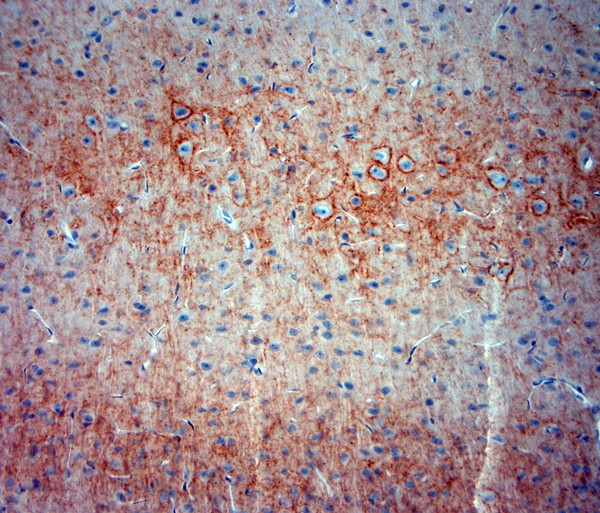 Synaptotagmin 2 Antibody in Immunohistochemistry (Paraffin) (IHC (P))