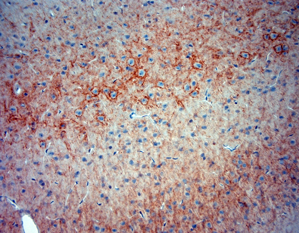 Synaptotagmin 2 Antibody in Immunohistochemistry (Paraffin) (IHC (P))