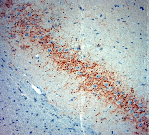 Synaptotagmin 2 Antibody in Immunohistochemistry (Paraffin) (IHC (P))