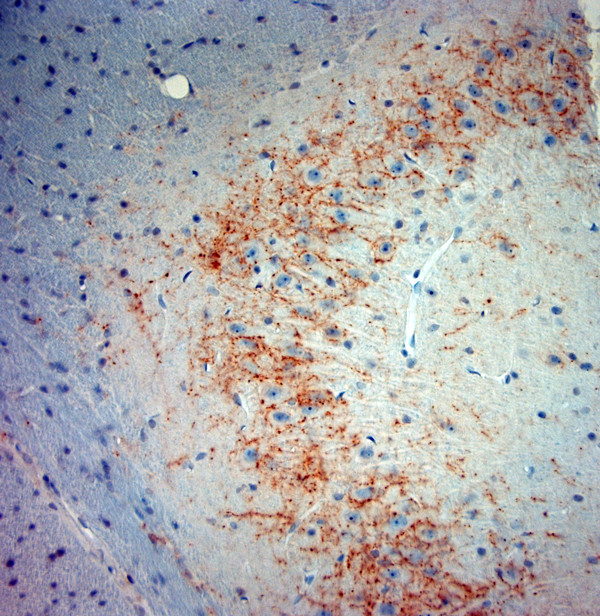 Synaptotagmin 2 Antibody in Immunohistochemistry (Paraffin) (IHC (P))