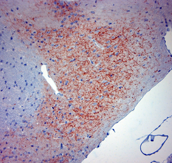 Synaptotagmin 2 Antibody in Immunohistochemistry (Paraffin) (IHC (P))