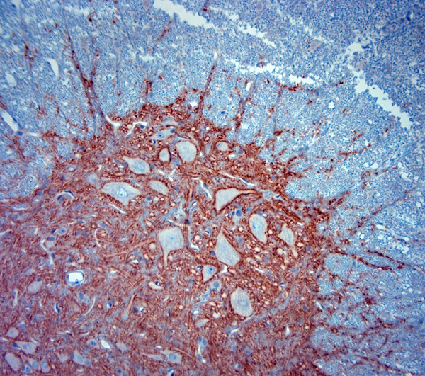 Synaptotagmin 2 Antibody in Immunohistochemistry (Paraffin) (IHC (P))