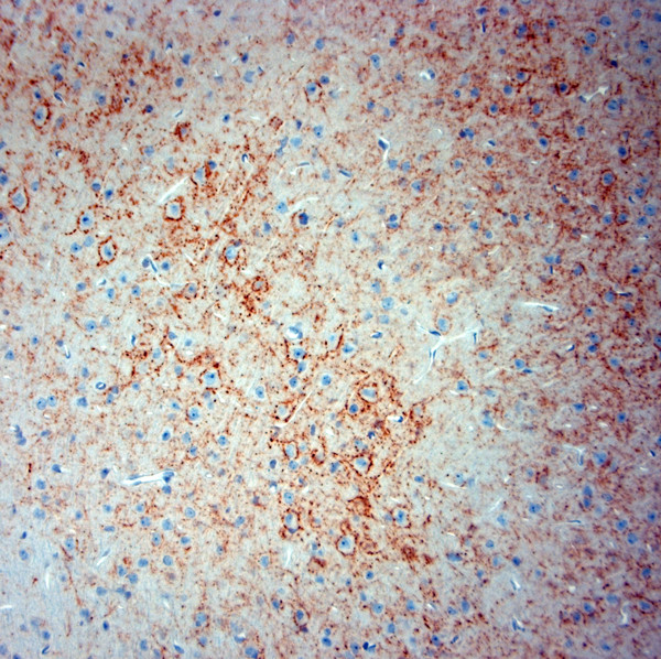 Synaptotagmin 2 Antibody in Immunohistochemistry (Paraffin) (IHC (P))