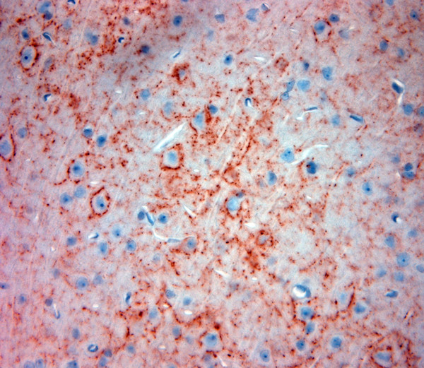 Synaptotagmin 2 Antibody in Immunohistochemistry (Paraffin) (IHC (P))