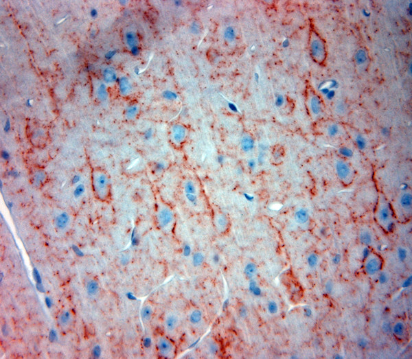 Synaptotagmin 2 Antibody in Immunohistochemistry (Paraffin) (IHC (P))