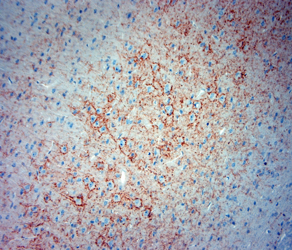 Synaptotagmin 2 Antibody in Immunohistochemistry (Paraffin) (IHC (P))