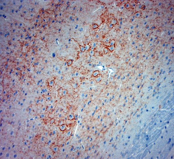 Synaptotagmin 2 Antibody in Immunohistochemistry (Paraffin) (IHC (P))