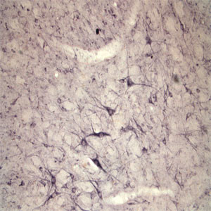 Sortilin Antibody in Immunohistochemistry (IHC)