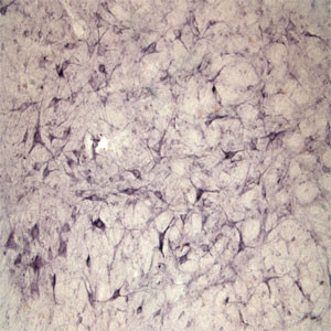 Sortilin Antibody in Immunohistochemistry (IHC)