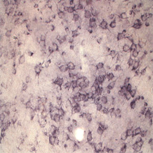 Sortilin Antibody in Immunohistochemistry (IHC)