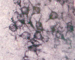 Sortilin Antibody in Immunohistochemistry (IHC)