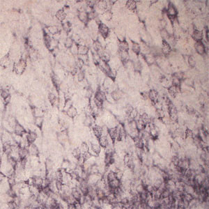 Sortilin Antibody in Immunohistochemistry (IHC)