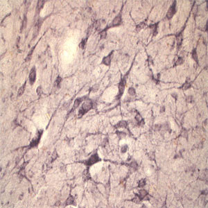 Sortilin Antibody in Immunohistochemistry (IHC)