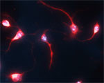 STB5L Antibody in Immunocytochemistry (ICC/IF)