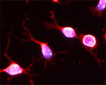 SCAMP1 Antibody in Immunocytochemistry (ICC/IF)