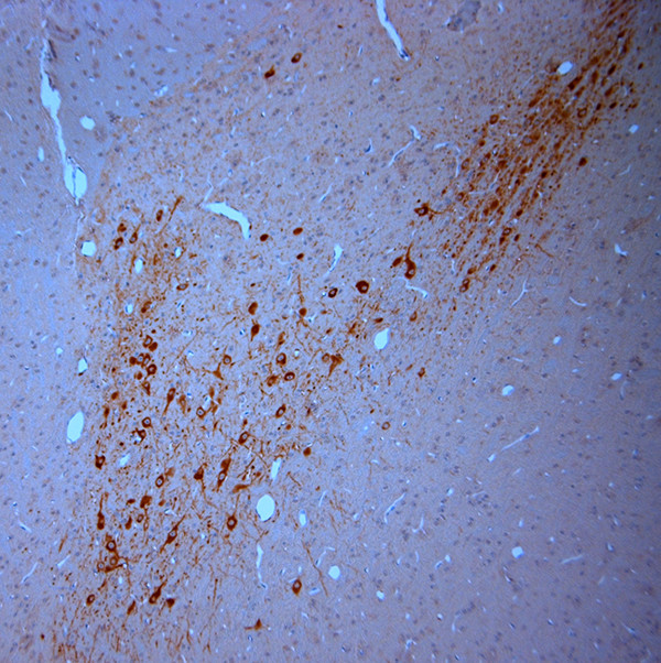 SNIP Antibody in Immunohistochemistry (Paraffin) (IHC (P))