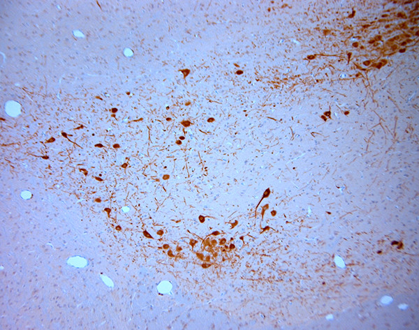 SNIP Antibody in Immunohistochemistry (Paraffin) (IHC (P))