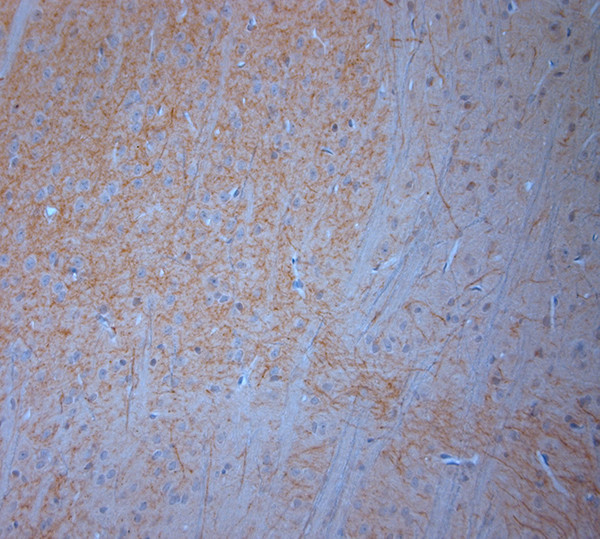 SNIP Antibody in Immunohistochemistry (Paraffin) (IHC (P))