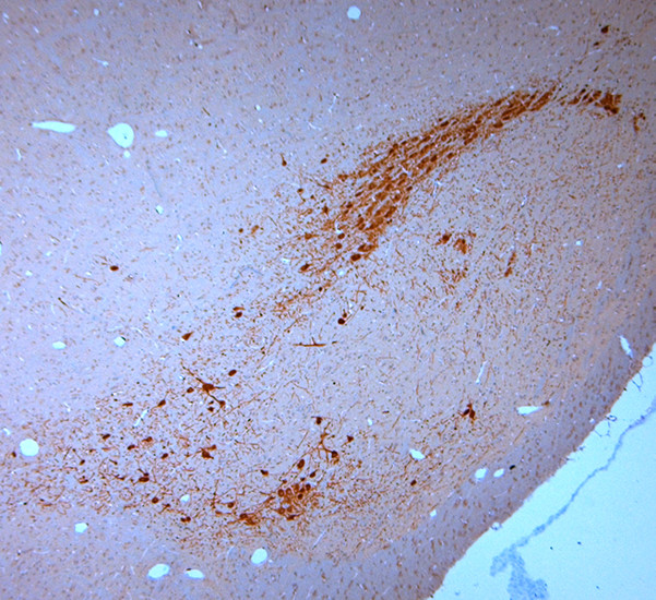 SNIP Antibody in Immunohistochemistry (Paraffin) (IHC (P))