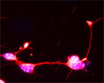 SYT17 Antibody in Immunocytochemistry (ICC/IF)