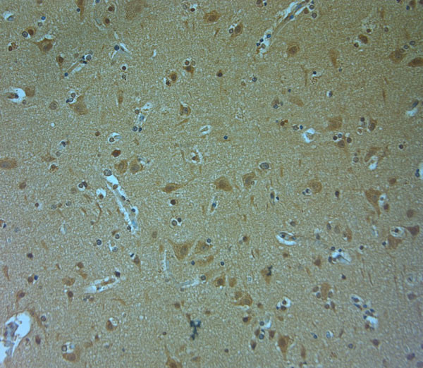 Nav1.8 Antibody in Immunohistochemistry (Paraffin) (IHC (P))