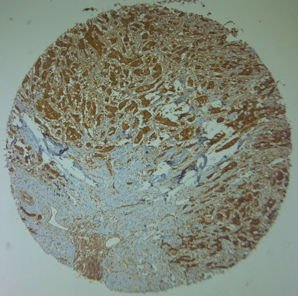 Nav1.8 Antibody in Immunohistochemistry (Paraffin) (IHC (P))