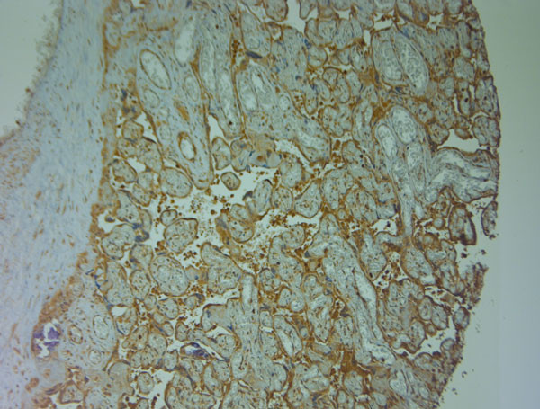 Nav1.8 Antibody in Immunohistochemistry (Paraffin) (IHC (P))