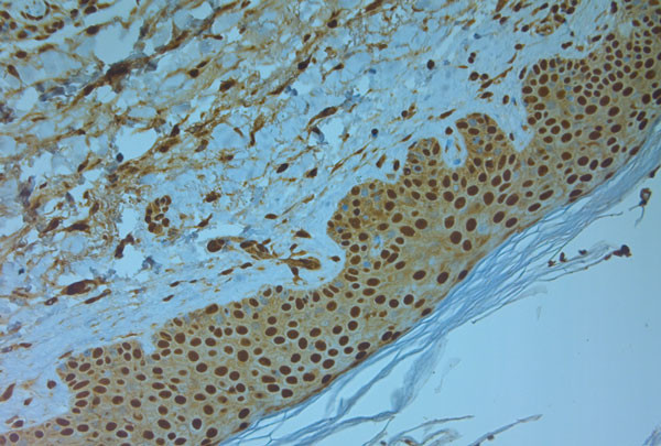 Nav1.8 Antibody in Immunohistochemistry (Paraffin) (IHC (P))