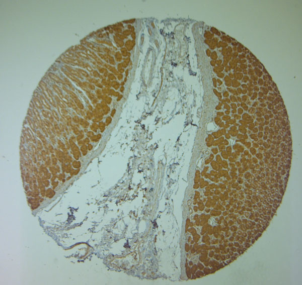 Nav1.8 Antibody in Immunohistochemistry (Paraffin) (IHC (P))