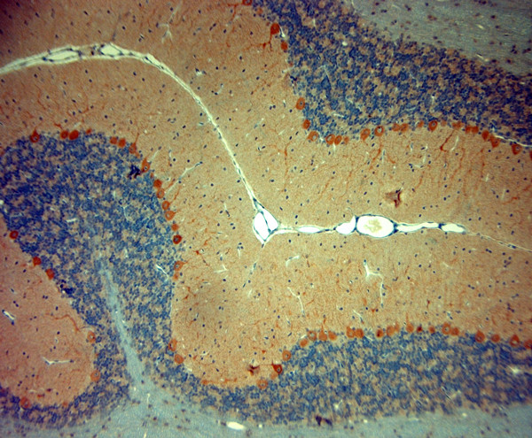 STIM1 Antibody in Immunohistochemistry (Paraffin) (IHC (P))