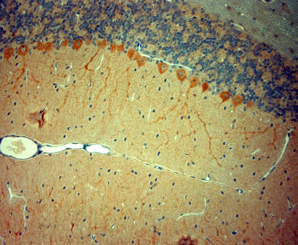 STIM1 Antibody in Immunohistochemistry (Paraffin) (IHC (P))