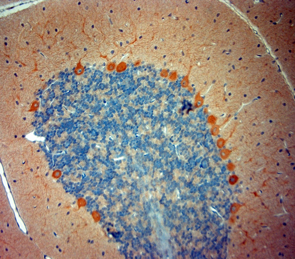 STIM1 Antibody in Immunohistochemistry (Paraffin) (IHC (P))