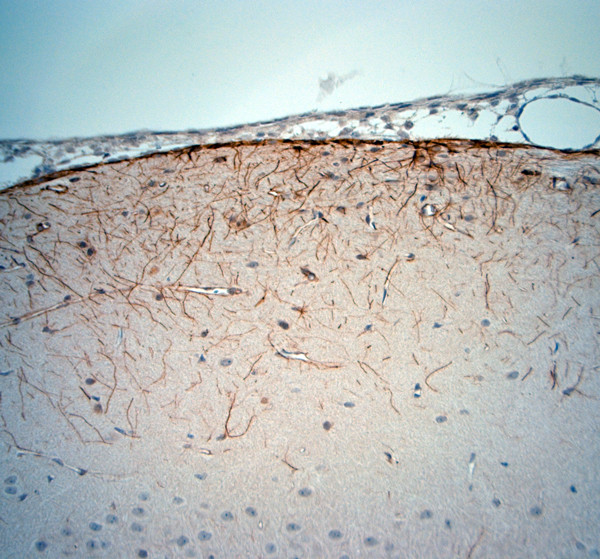 5HT1D R Antibody in Immunohistochemistry (Paraffin) (IHC (P))