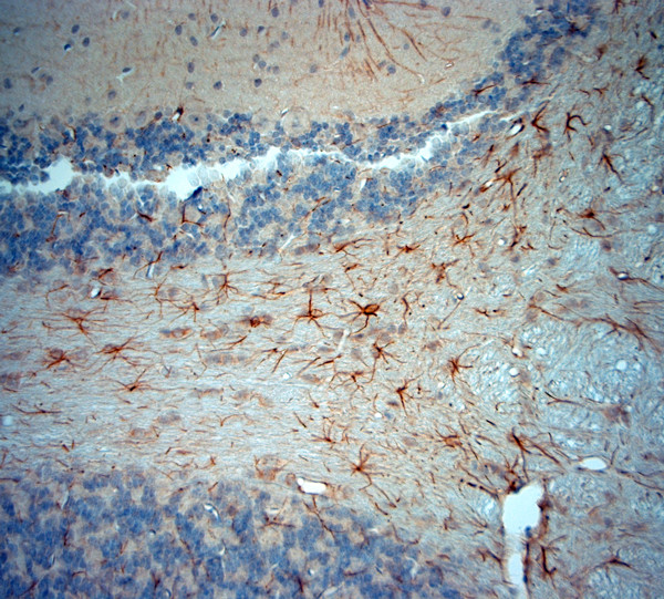 5HT1D R Antibody in Immunohistochemistry (Paraffin) (IHC (P))