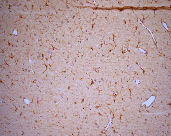 5HT1D R Antibody in Immunohistochemistry (Paraffin) (IHC (P))