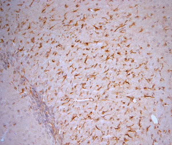 5HT1D R Antibody in Immunohistochemistry (Paraffin) (IHC (P))