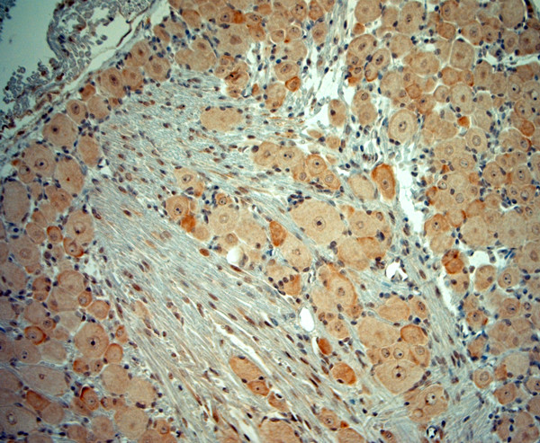 5HT1D R Antibody in Immunohistochemistry (Paraffin) (IHC (P))