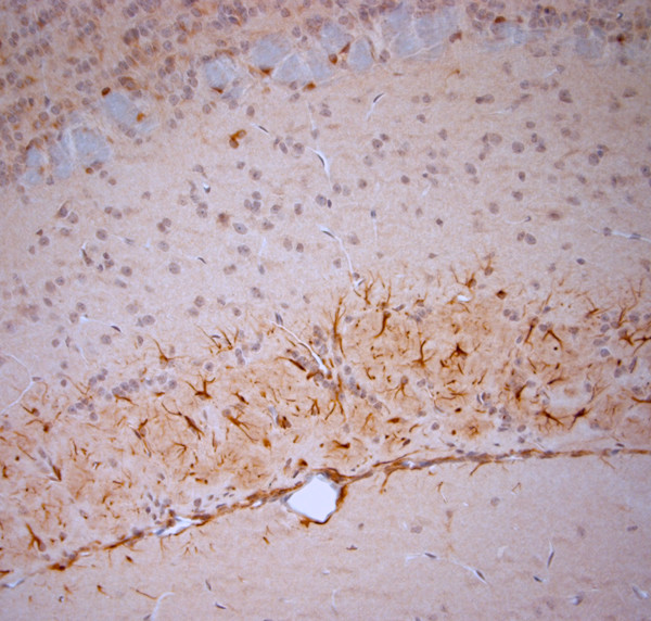 5HT1D R Antibody in Immunohistochemistry (Paraffin) (IHC (P))