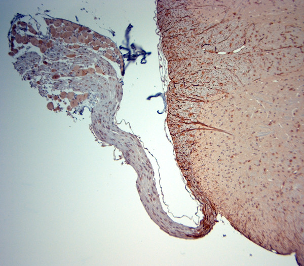 5HT1D R Antibody in Immunohistochemistry (Paraffin) (IHC (P))