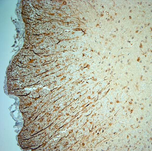 5HT1D R Antibody in Immunohistochemistry (Paraffin) (IHC (P))