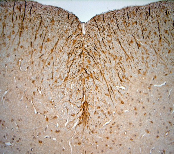 5HT1D R Antibody in Immunohistochemistry (Paraffin) (IHC (P))