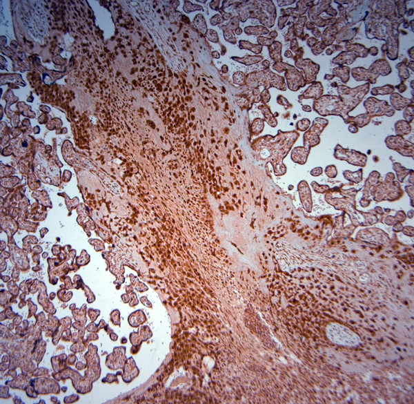 SRD5A2 Antibody in Immunohistochemistry (Paraffin) (IHC (P))